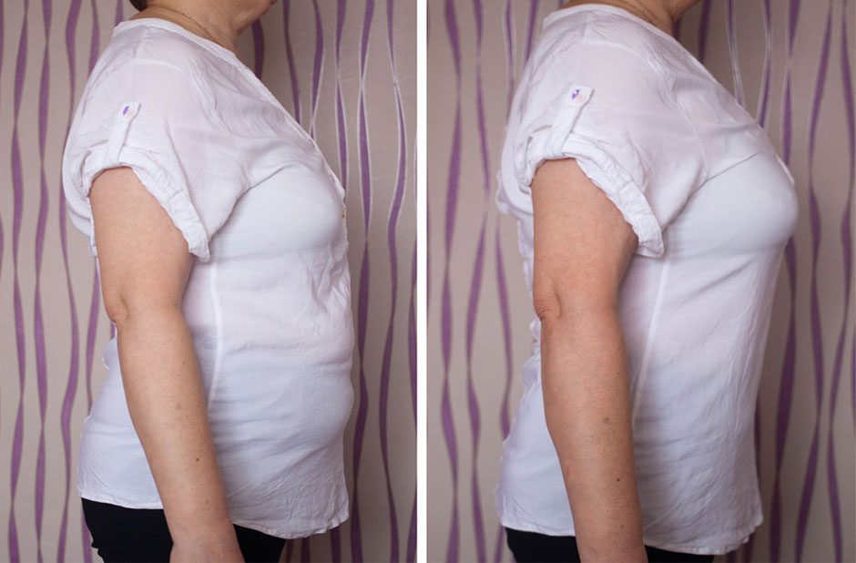 Before/After Photo 4